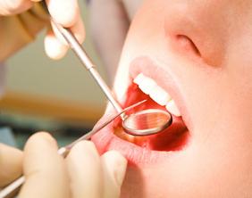 Symptoms of Poor Dental Care